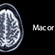 Illustration for article titled Your Brain Scan Looks Different on Mac and PC